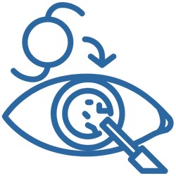 Cirurgia de <br> Catarata